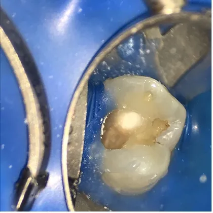 525a91_54d48cc0fa544fb5a5fd2a2